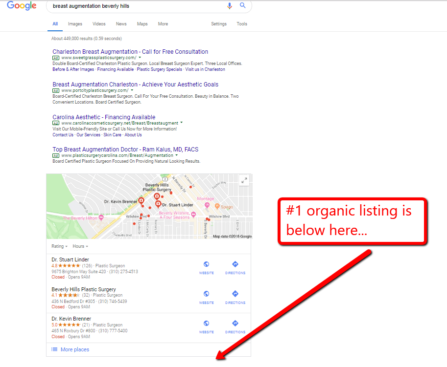 Google Ads and Map Listings